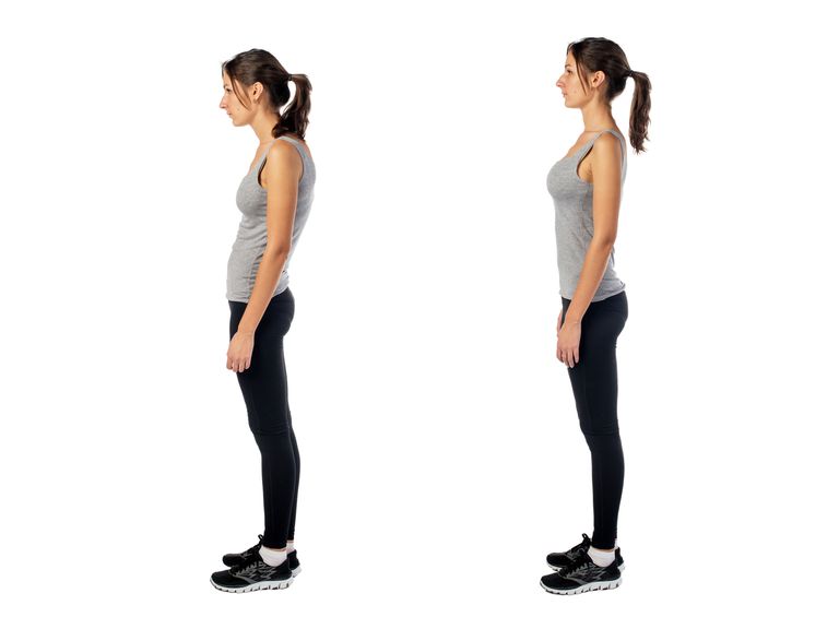 Postura de Swayback - Una desviación de la alineación normal del cuerpo