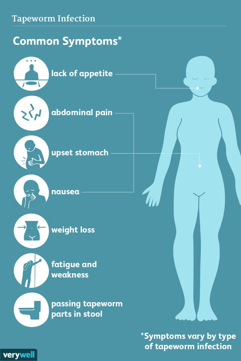 Infección por tenia: signos, síntomas y complicaciones