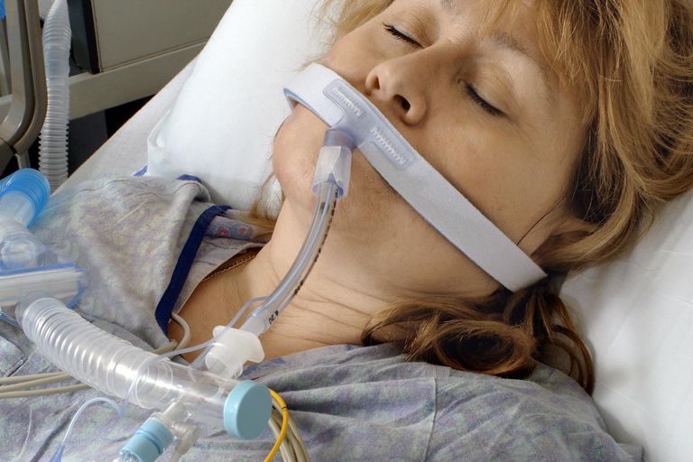 Cirugía P Neumonía asociada a ventilador (VAP), también conocida como neumonía adquirida por ventilador, es una neumonía que se desarrolla 48 horas o más después de que el paciente es intubado. La neumonía que se desarrolla en las primeras 48 horas del tiempo de un paciente conectado al respirador, o estuvo presente cuando el paciente fue colocado en el respirador, no se considera asociado al ventilador porque la neumonía estaba presente antes de que se usara el respirador.