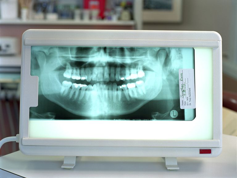 ¿Qué son los registros dentales de ortodoncia?