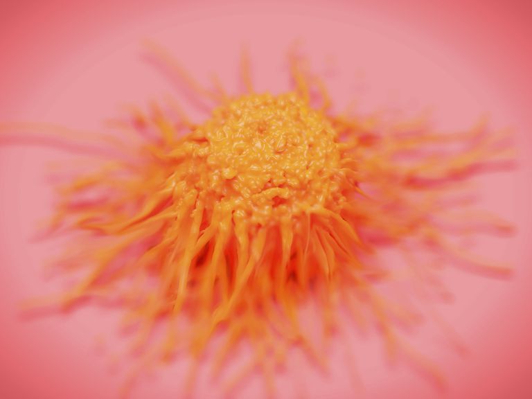 ¿Qué son los tumores de células de Sertoli-Leydig del ovario?
