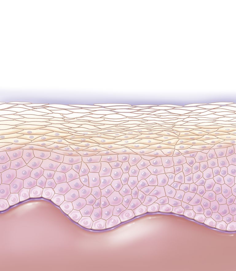 ¿Qué causa los brotes de acné?