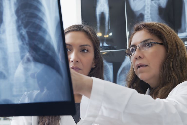 Lo que una radiografía de tórax puede decirle sobre su EPOC