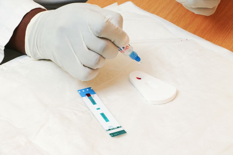 ¿Qué significa un resultado negativo de la prueba del VIH?