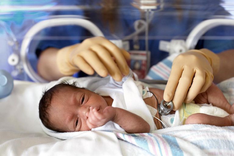 ¿Qué es la parálisis cerebral (PC) en bebés prematuros?
