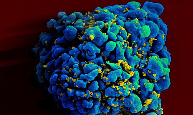 ¿Qué es el VIH-2?