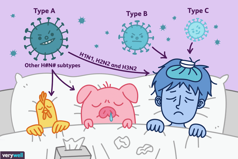 ¿Qué es la influenza?