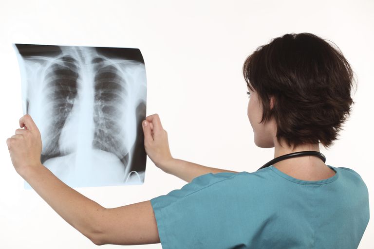¿Qué es una Infección Respiratoria Inferior?