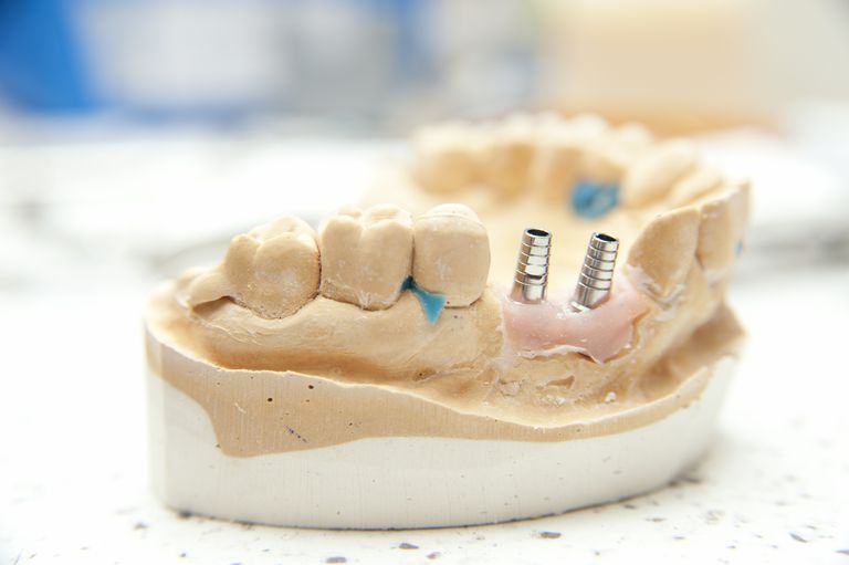 ¿Qué es cirugía oral y cómo se usa?