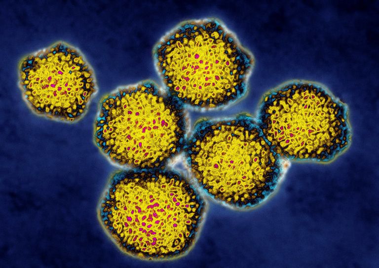 ¿Qué es una carga viral para la hepatitis C?