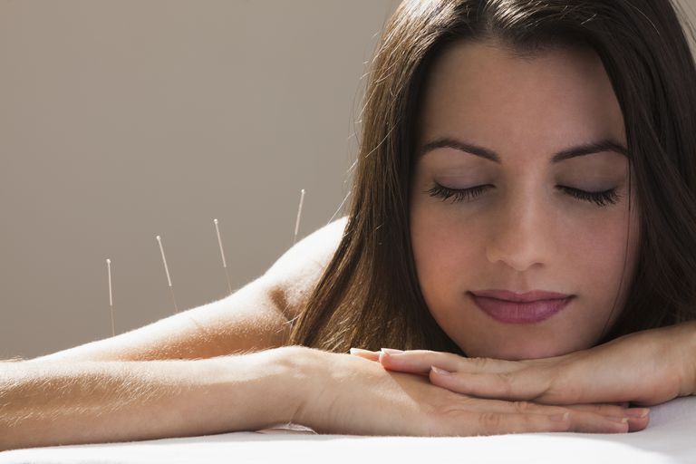 ¿Qué es la acupuntura con Fibromialgia y EM / SFC? Sy Síndrome de fatiga crónica y fibromialgia