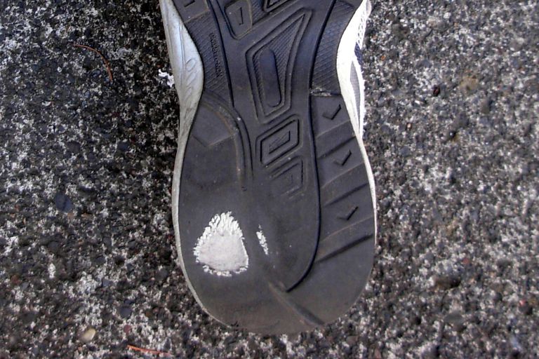 Qué significan los patrones de desgaste para los zapatos para caminar