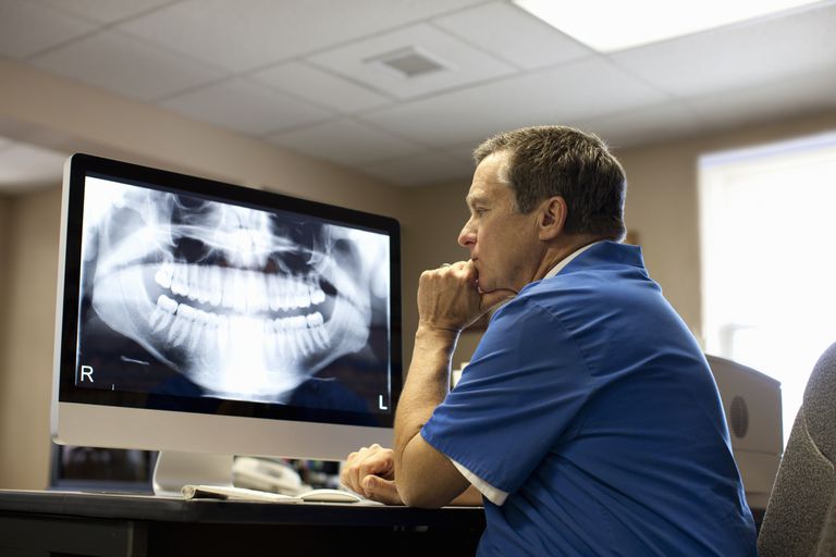 Lo que debe saber sobre las radiografías dentales