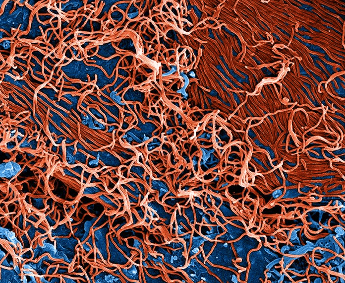 Lo que debe saber sobre el ébola