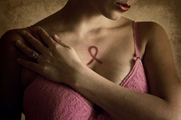 Lo que debe saber sobre el cáncer de mama metaplásico