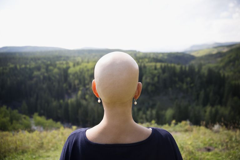 ¿Cuándo perderás pelo durante la quimioterapia?