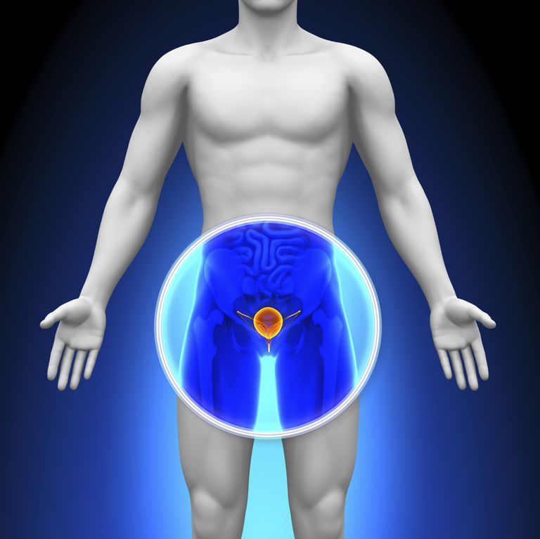 Por qué el cáncer de próstata temprano no presenta síntomas